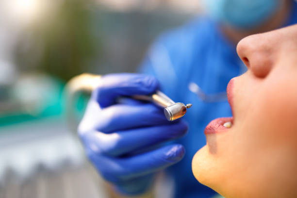 Dental Bonding in Ocean Shores, WA